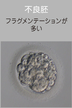 フラグメーション多数フラグメンテーションが多い