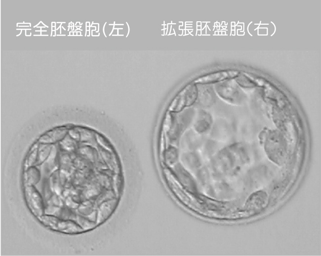胚盤胞（左）　拡張胚盤胞（右）